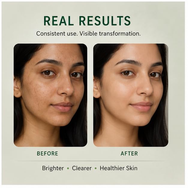 Flawless Skin Brightening Serum with Vitamin C, Niacinamide & Kojic Acid | Helps Improve Skin Radiance, Evens Skin Tone & Reduces Dullness | Lightweight Daily Face Serum for Men & Women | 30ml