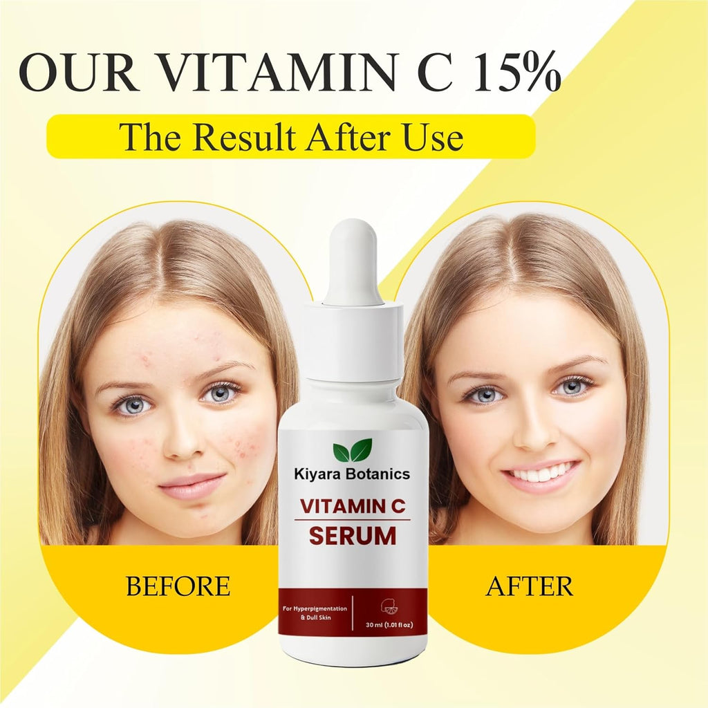 Kiyara Botanics Vitamin C Serum for Hyperpigmentation, Dark Spots and Dull Skin, Paraben Free Formula, Unscented, 30ml