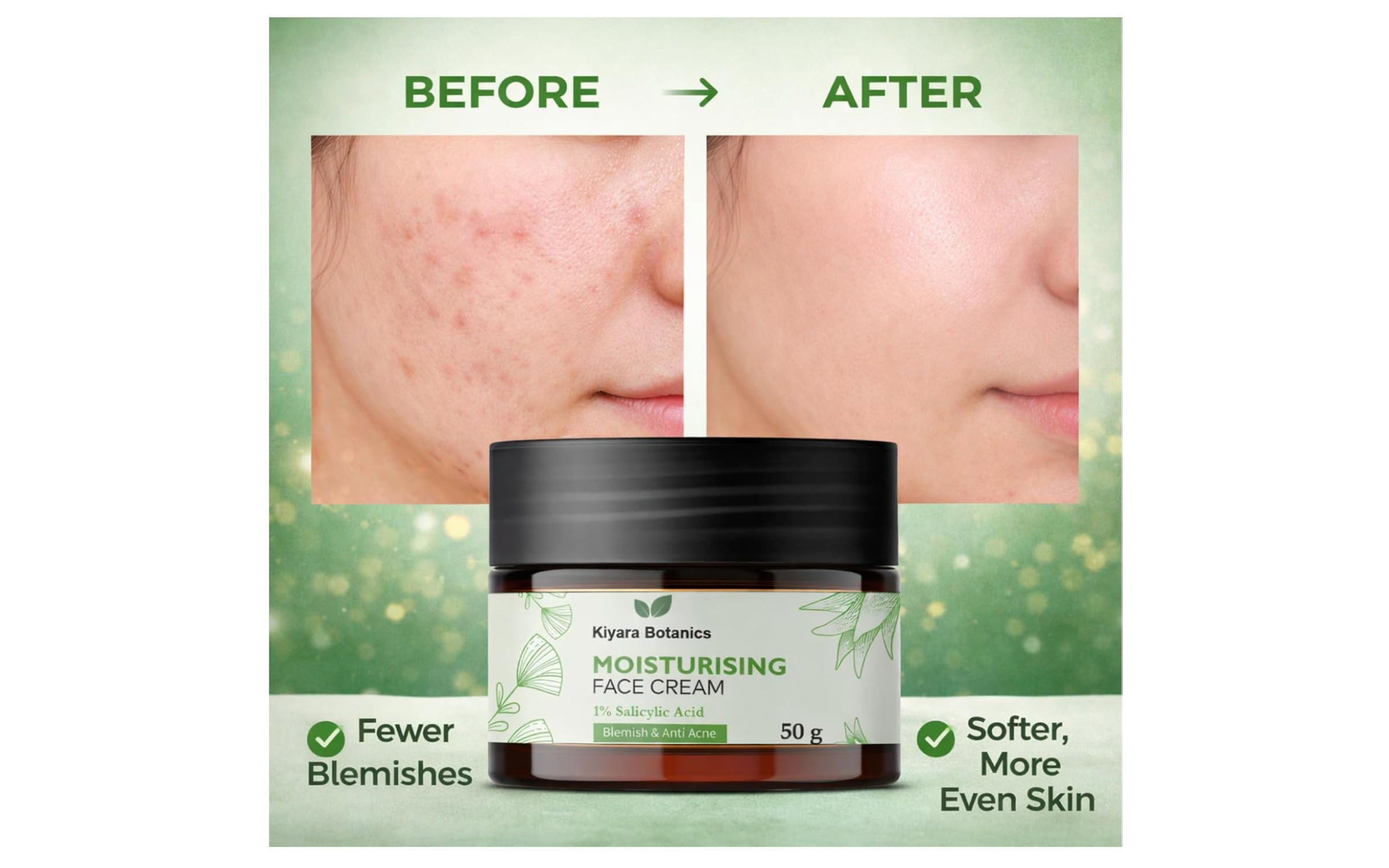 Kiyara Botanics Moisturising Face Cream with 1% Salicylic Acid for Acne & Blemish Control - Lightweight Hydrating Anti-Acne Cream for Clear, Smooth, Oil-Free Skin