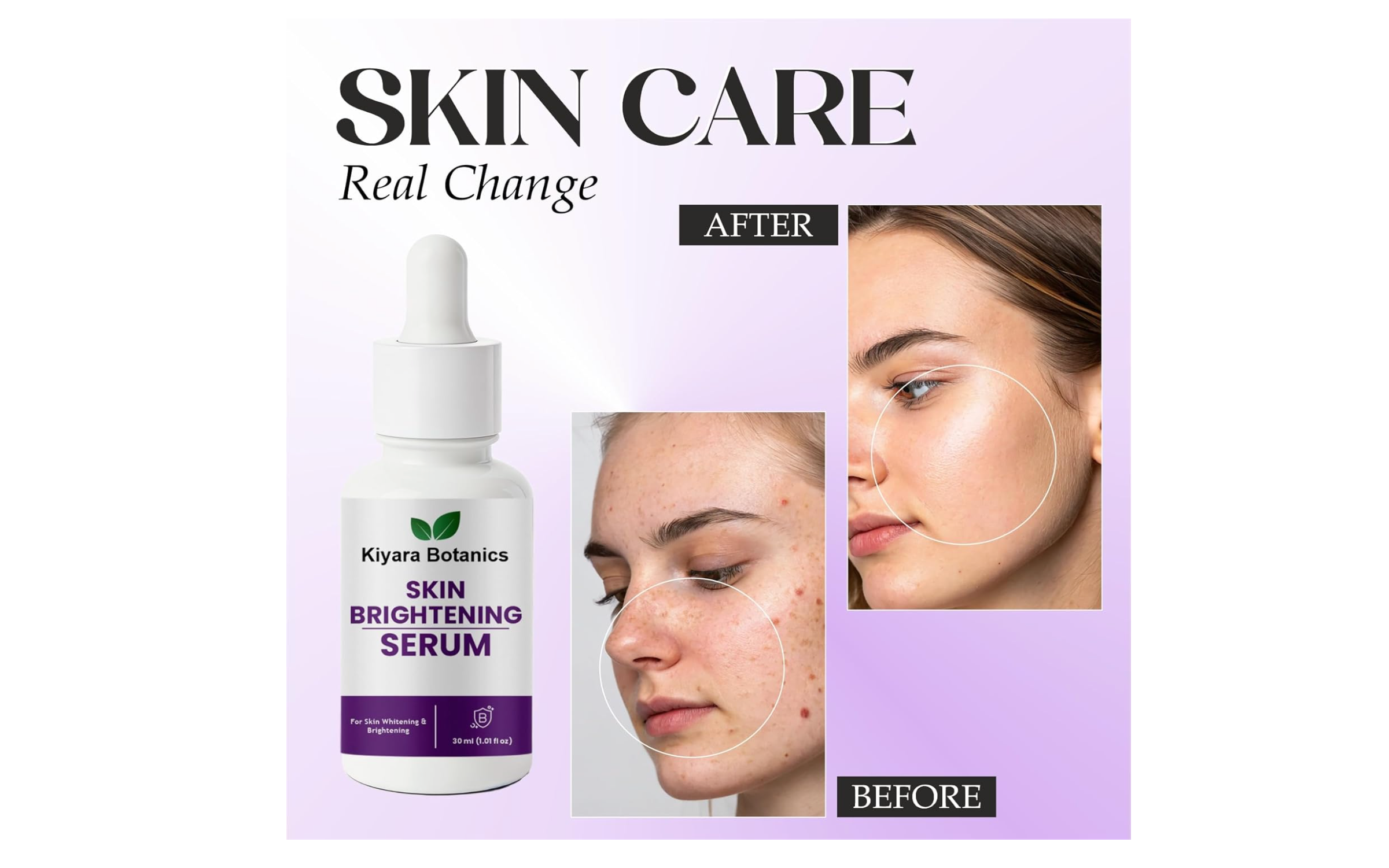 Kiyara Botanics Skin Brightening Serum for Whitening and Brightening, Natural Botanical Formula, 30ml (1.01 fl oz)
