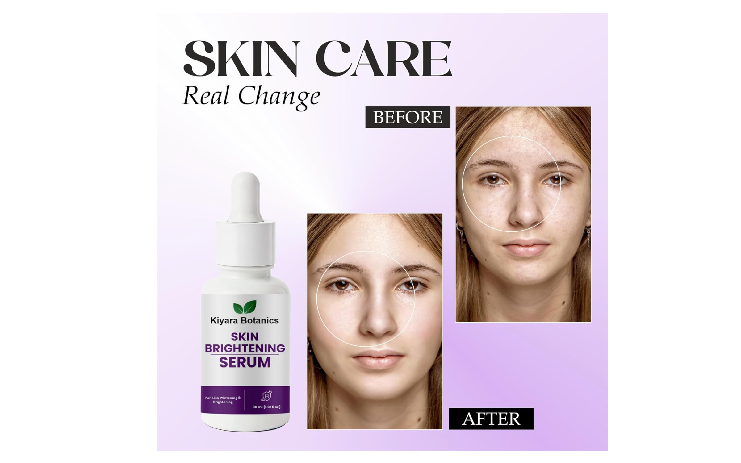 Kiyara Botanics Skin Brightening Serum for Whitening and Brightening, Natural Botanical Formula, 30ml (1.01 fl oz)